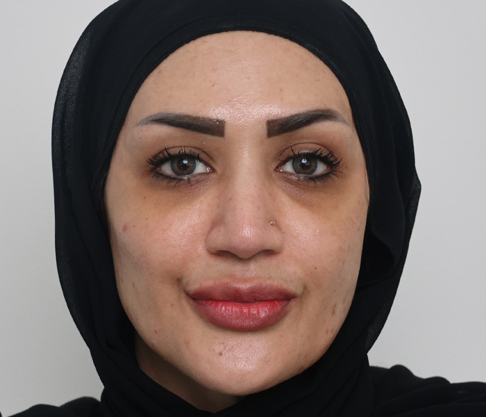 بعد4