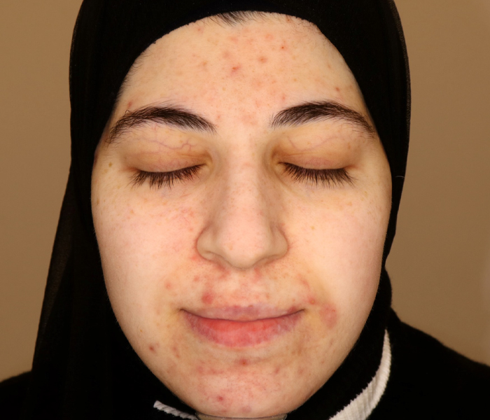 قبل7